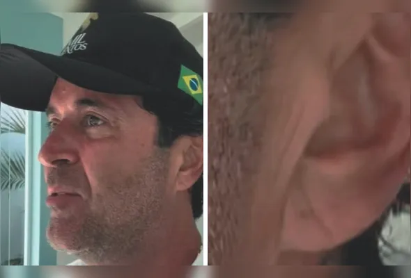 Henrique Maderite,  de 50 anos, tinha o Sinal de Frank na orelha
