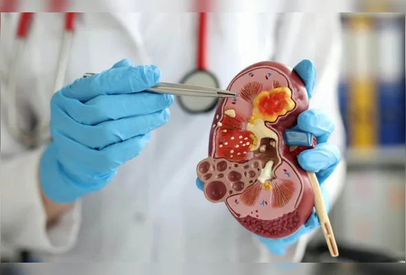 Médico mostra modelo de rim