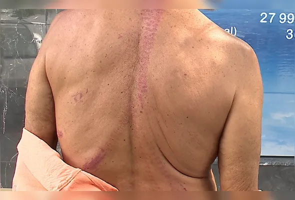 Idoso argentino de 64 anos foi agredido por criminosos