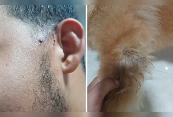 Jovem e o cachorro chow-chow ficaram feridos no ataque do pitbull