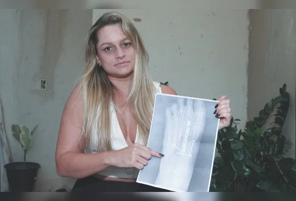 Mhayara Baldon viu a rotina mudar completamente após um acidente de moto, que envolveu cirurgia e semanas sem poder apoiar o pé no chão