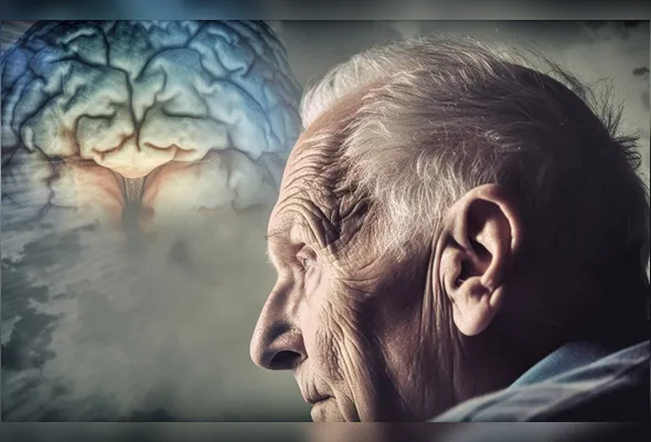 Alzheimer é uma doença neurodegenerativa progressiva sem cura