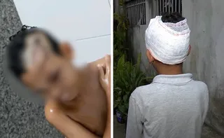 Imagem ilustrativa da imagem Menino de 8 anos é atacado por cachorro em Vila Velha e fica ferido
