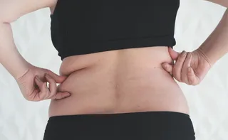 Imagem ilustrativa da imagem Três suplementos que merecem atenção de quem tem lipedema