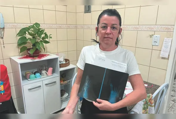 Raquel: 15 pinos no braço direito