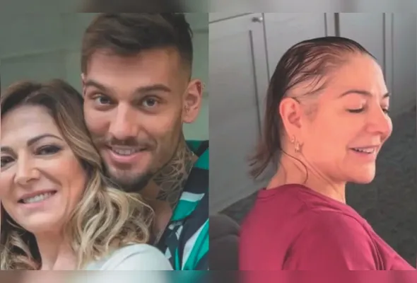 Karina ao lado de Lucas e com falhas no couro cabeludo: fatores como genética e estresse influenciam na condição