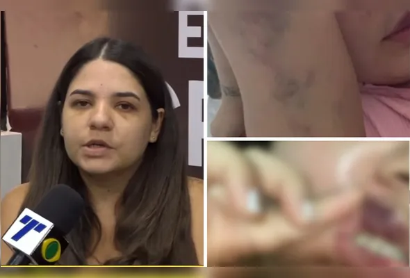 Fernanda Barros, de 27 anos, sobreviveu a uma tentativa de feminicídio dentro da própria casa