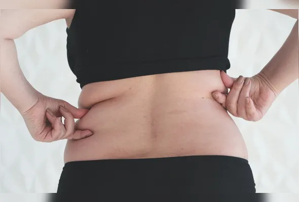 Imagem ilustrativa da imagem Três suplementos que merecem atenção de quem tem lipedema