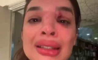Imagem ilustrativa da imagem Suposta violência patrimonial contra dentista agredida por empresário é investigada