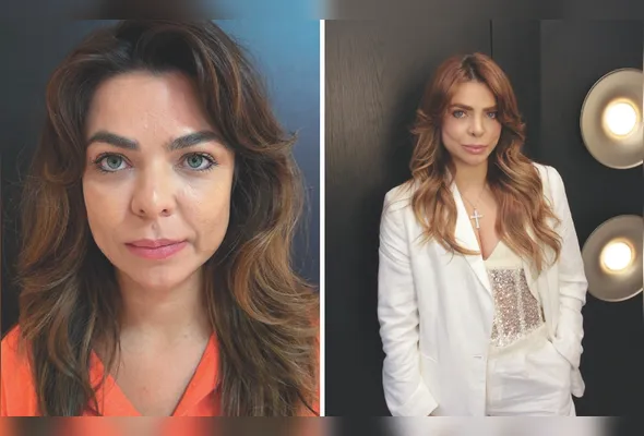 Ana Paula Leitte optou pelo deep plane, uma das técnicas mais modernas da cirurgia plástica facial