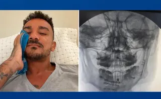 Imagem ilustrativa da imagem Danilo, do Flamengo, mostra recuperação após fratura na mandíbula