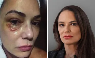 Imagem ilustrativa da imagem Luiza Brunet comenta indenização de R$ 150 mil por agressão de ex