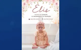 Imagem ilustrativa da imagem Morre Elis, gêmea com síndrome de envelhecimento precoce; entenda a doença