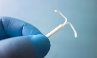 Imagem ilustrativa da imagem Planos de saúde terão que cobrir DIU hormonal em casos de endometriose