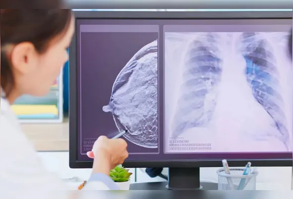 Imagem ilustrativa da imagem IA já ajuda médicos na detecção do câncer de mama
