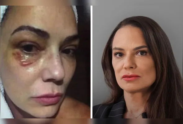 Imagem ilustrativa da imagem Luiza Brunet comenta indenização de R$ 150 mil por agressão de ex