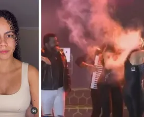 Imagem ilustrativa da imagem Após cabelo pegar fogo em show, Nath Souza se afasta com síndrome do pânico