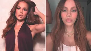 Imagem ilustrativa da imagem Novos procedimentos de Anitta priorizam naturalidade, dizem especialistas