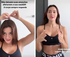 Imagem ilustrativa da imagem Franciny Ehlke revela que perdeu cabelo por estresse e fala sobre alopecia