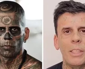 Imagem ilustrativa da imagem Mais tatuado do Brasil aparece irreconhecível após remoção de tatuagens