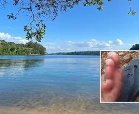 Imagem ilustrativa da imagem Banhistas relatam mordidas e temem presença de piranhas em lagoa de Linhares