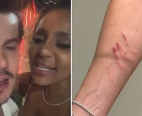 Imagem ilustrativa da imagem Cariúcha acusa médico de agressão; ele nega e afirma ter sido arranhado pela