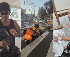 Imagem ilustrativa da imagem Chef de cozinha faz alerta após acidente com moto elétrica: "Usem capacete"