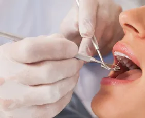 Imagem ilustrativa da imagem Consumo de açúcar exige cuidado extra com a saúde bucal