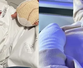 Imagem ilustrativa da imagem Estudante brasileiro de 9 anos tem dois dedos decepados em escola de Portugal