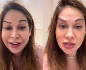 Imagem ilustrativa da imagem Maíra Cardi exibe rosto deformado após botox dar errado: 'Olha que palhaçada'