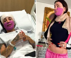 Imagem ilustrativa da imagem Maya Massafera exibe ossos que tirou do maxilar em nova cirurgia nas redes sociais