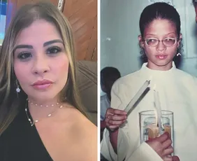 Imagem ilustrativa da imagem Paciente com 28 graus de miopia volta a enxergar: "Meu caso era de cegueira"