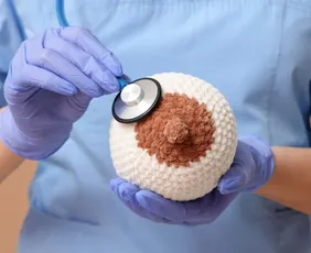 Imagem ilustrativa da imagem Por que o câncer de mama está mais comum em jovens?