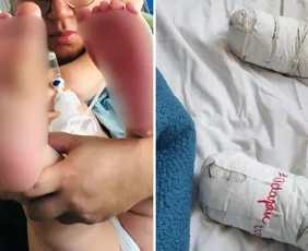 Imagem ilustrativa da imagem Bebê sofre queimaduras nos pés após pisar em chão quente em creche na Serra