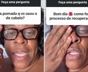 Imagem ilustrativa da imagem Cacau Protásio volta a enxergar após cegueira temporária e faz alerta sobre produto