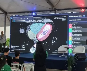 Imagem ilustrativa da imagem Com apoio do Programa Sementes, startups do ES ganham vitrine no SUS digital