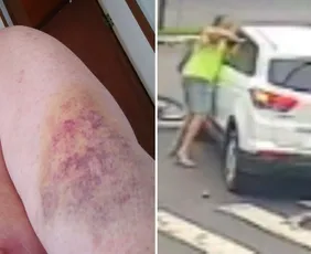 Imagem ilustrativa da imagem Dentista é indiciado após agredir idoso com socos em briga no trânsito em Vitória