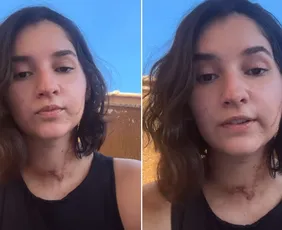 Imagem ilustrativa da imagem Estudante esfaqueada 15 vezes convoca manifestação por justiça no Rio