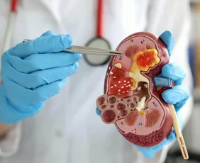 Imagem ilustrativa da imagem Exames gratuitos para detectar problemas nos rins