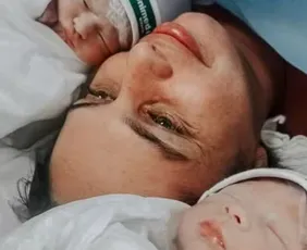 Imagem ilustrativa da imagem Gêmeos nascem empelicados em hospital de Vitória; caso é considerado raro