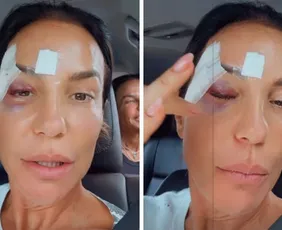Imagem ilustrativa da imagem Ivete Sangalo recebe alta hospitalar e revela diagnóstico de síndrome vasovagal