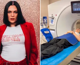 Imagem ilustrativa da imagem Jessie J bate a cabeça e vai parar no hospital na China