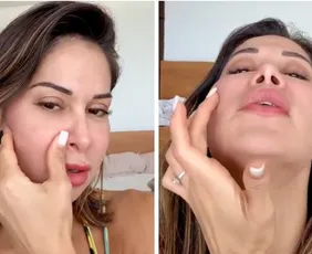 Imagem ilustrativa da imagem Maíra Cardi passará por cirurgia delicada após deformação no rosto