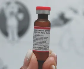 Imagem ilustrativa da imagem Médicos explicam risco de surto de sarampo