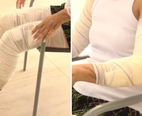 Imagem ilustrativa da imagem Mulher é perseguida e atropelada por ex após sair de bloco de Carnaval na Serra