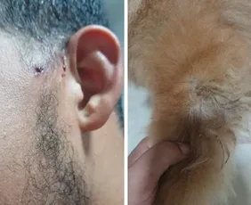 Imagem ilustrativa da imagem Pitbull ataca jovem e chow-chow duas vezes no Perocão, em Guarapari