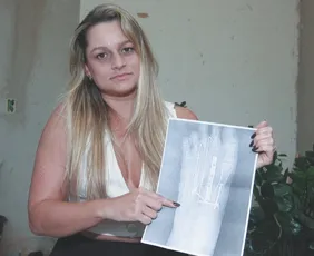 Imagem ilustrativa da imagem Sobreviventes de acidentes com motos lutam contra dores e depressão