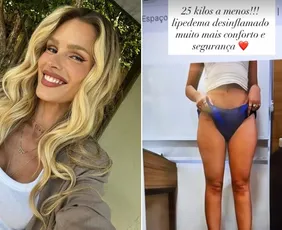 Imagem ilustrativa da imagem Yasmin Brunet revela ter perdido 25 kg em tratamento contra lipedema