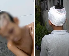 Imagem ilustrativa da imagem Menino de 8 anos é atacado por cachorro em Vila Velha e fica ferido