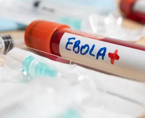 Imagem ilustrativa da imagem Secretário de Trump critica OMS por surto de ebola no Congo: 'Demora'